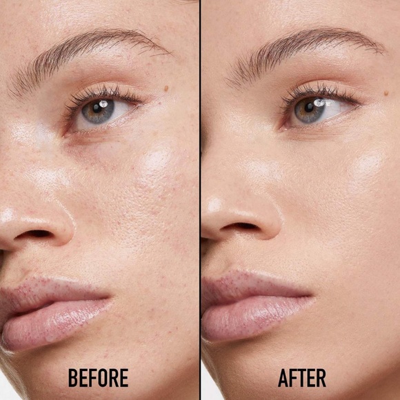 Dior Forever Skin Correct Concealer Shade 1,5 N Neutral - Picture 8 of 11